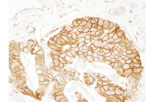 Immunohistochemistry (IHC) image for anti-Catenin, beta (CATNB) (AA 760-781) antibody (ABIN7448432) (beta Catenin Antikörper  (AA 760-781))