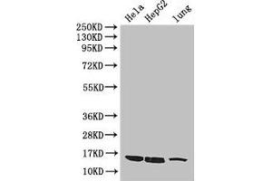 Western Blot Positive WB detected in: Hela whole cell lysate, HepG2 whole cell lysate, Mouse lung tissue All lanes: CISD2 antibody at 3 μg/mL Secondary Goat polyclonal to rabbit IgG at 1/50000 dilution Predicted band size: 16 kDa Observed band size: 16 kDa (CISD2 Antikörper  (AA 61-135))