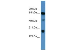 WB Suggested Anti-CANX Antibody Titration: 1. (Calnexin Antikörper  (Middle Region))