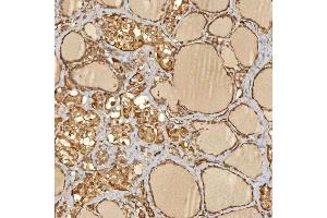 IHC analysis of SNX4 using anti-SNX4 antibody (ABIN7599406). (Sorting Nexin 4 Antikörper  (AA 1-450))