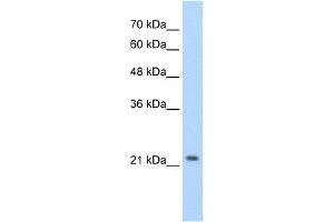 WB Suggested Anti-DLX2 Antibody Titration:  2. (DLX2 Antikörper  (C-Term))
