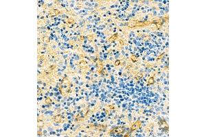Immunohistochemistry (Paraffin-embedded Sections) (IHC (p)) image for anti-Homer Homolog 3 (Drosophila) (HOMER3) antibody (ABIN7074257)