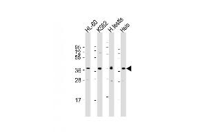 All lanes : Anti-PRSS21 Antibody (N-Term) at 1:1000-1:2000 dilution Lane 1: HL-60 whole cell lysate Lane 2: K562 whole cell lysate Lane 3: human testis lysate Lane 4: Hela whole cell lysate Lysates/proteins at 20 μg per lane.