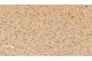 Detection of MYO in Rat Cardiac Muscle Tissue using Polyclonal Antibody to Myoglobin (MYO) (Myoglobin Antikörper  (AA 1-154))