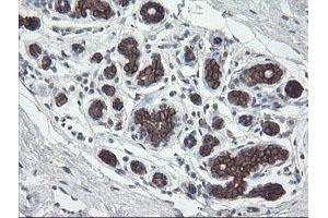 Immunohistochemical staining of paraffin-embedded Human breast tissue using anti-DPH2 mouse monoclonal antibody. (DPH2 Antikörper)