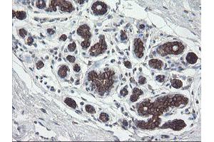 Immunohistochemical staining of paraffin-embedded Human breast tissue using anti-DPH2 mouse monoclonal antibody.