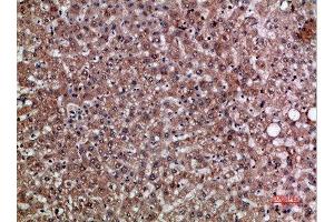 Immunohistochemical analysis of paraffin-embedded human-liver, antibody was diluted at 1:200 (CXCL12 Antikörper  (AA 31-80))