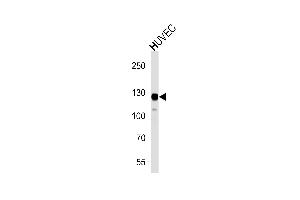 Western blot analysis of lysate from HUVEC cell line,using PTK2 Antibody (N-term) (ABIN1882052 and ABIN2843641). (FAK Antikörper  (N-Term))