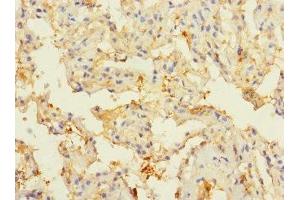 Immunohistochemistry of paraffin-embedded human lung tissue using ABIN7148571 at dilution of 1:100 (CIR1 Antikörper  (AA 1-160))