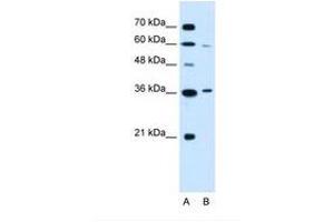 Image no. 2 for anti-Presenilin Associated, Rhomboid-Like (PARL) (AA 97-146) antibody (ABIN6738135) (PARL Antikörper  (AA 97-146))