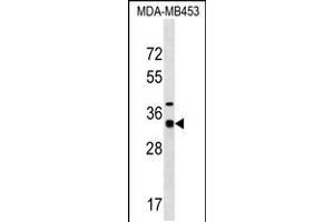 Western blot analysis in MDA-MB453 cell line lysates (35ug/lane). (MYOZ2 Antikörper  (N-Term))