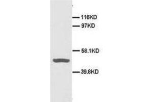 Western blot analysis of Hela cell lysis using CD40 antibody (CD40 Antikörper  (N-Term))