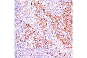 Immunohistochemistry of paraffin-embedded mouse spleen using MZB1 antibody (ABIN7268403) at dilution of 1:100 (40x lens). (MZB1 Antikörper  (AA 1-189))