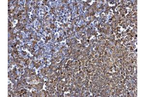 Immunohistochemistry (IHC) image for anti-Spleen tyrosine Kinase (SYK) (Internal Region) antibody (ABIN2854855)