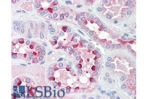 ABIN768559 (5µg/ml) staining of paraffin embedded Human Kidney. (IDH3G Antikörper  (AA 337-350))