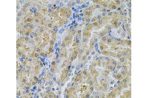 Immunohistochemistry of paraffin-embedded Mouse kidney using SERPINA6 Polyclonal Antibody at dilution of 1:100 (40x lens). (SERPINA6 Antikörper)