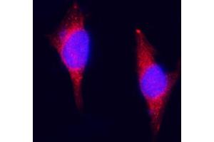 IF analysis of ZAC/Plagl1 using anti-ZAC/Plagl1 antibody (ABIN7599464). (PLAGL1 Antikörper  (AA 1-527))
