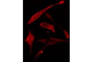 ABIN6274778 staining A549 cells by IF/ICC. (RPL30 Antikörper  (C-Term))