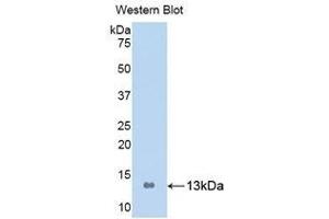 Western Blotting (WB) image for anti-S100 Calcium Binding Protein A8 (S100A8) (AA 1-93) antibody (ABIN1078510) (S100A8 Antikörper  (AA 1-93))