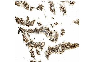 IHC analysis of STK3/MST-2 using anti STK3/MST-2 antibody (ABIN7601288).