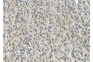 IHC analysis of SYP using anti-SYP antibody (ABIN7603120). (Synaptophysin Antikörper  (N-Term))