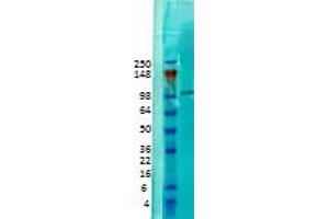 CASK Western Blot. (CASK Antikörper)