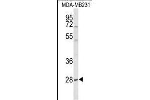 Western blot analysis of YIPF5 Antibody (N-term) (ABIN653506 and ABIN2842912) in MDA-M cell line lysates (35 μg/lane). (YIPF5 Antikörper  (N-Term))
