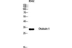 Western Blot (WB) analysis of K562 using Otubain-1 antibody. (OTUB1 Antikörper)