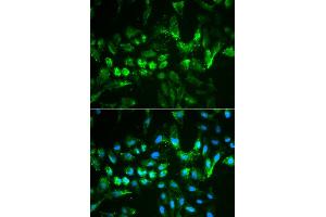 Immunofluorescence analysis of MCF-7 cells using TIMP2 antibody. (TIMP2 Antikörper)