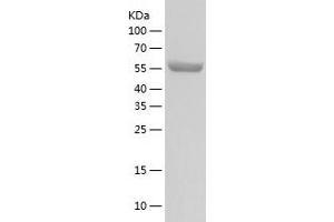 PPM1G Protein (AA 1-546) (His tag)