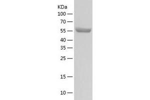 Western Blotting (WB) image for Protein Phosphatase, Mg2+/Mn2+ Dependent, 1G (PPM1G) (AA 1-546) protein (His tag) (ABIN7124674)