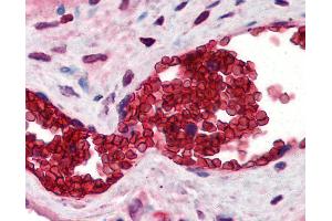 Anti-Band 3 antibody IHC of human placenta, erythrocytes. (Band 3/AE1 Antikörper  (N-Term))