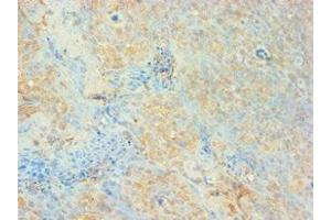 Immunohistochemistry of paraffin-embedded human tonsil tissue using ABIN7159650 at dilution of 1: 100 (AUH Antikörper  (AA 68-339))