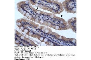 Human Intestine (SMPDL3B Antikörper  (N-Term))