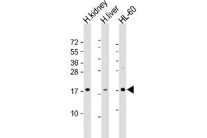 All lanes : Anti-FHIT Antibody (N-Term) at 1:2000 dilution Lane 1: human kidney lysate Lane 2: human liver lysate Lane 3: HL-60 whole cell lysate Lysates/proteins at 20 μg per lane. (FHIT Antikörper  (AA 19-54))