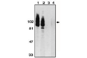 Image no. 1 for anti-ADAM Metallopeptidase Domain 17 (ADAM17) (AA 807-823), (C-Term) antibody (ABIN264994) (ADAM17 Antikörper  (C-Term))