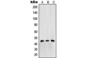 Western blot analysis of Mu Opioid Receptor (pS375) expression in HeLa (A), Raw264. (Mu Opioid Receptor 1 Antikörper  (C-Term, pSer375))