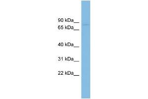 WB Suggested Anti-RAI16 Antibody Titration: 0. (FAM160B2 Antikörper  (N-Term))