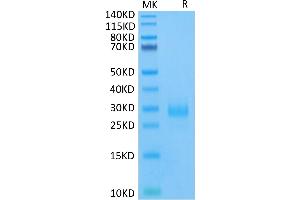 Human CD160 on Tris-Bis PAGE under reduced condition. (CD160 Protein (CD160) (AA 25-158) (His-Avi Tag))