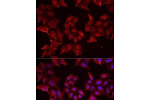 Immunofluorescence analysis of MCF7 cells using PCBD1 Polyclonal Antibody (PCBD1 Antikörper)