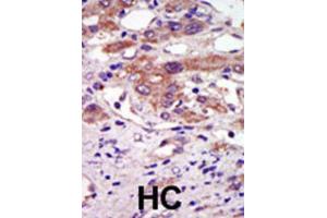 Immunohistochemistry (IHC) image for anti-Ribosomal Protein S6 Kinase, 90kDa, Polypeptide 6 (RPS6KA6) antibody (ABIN5023859) (RPS6KA6 Antikörper)