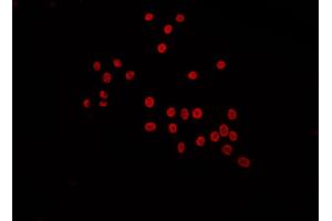 ABIN6272529 staining Hela by IF/ICC. (LARP1B Antikörper  (Internal Region))