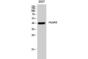 Western Blotting (WB) image for anti-Homeobox A5 (HOXA5) (N-Term) antibody (ABIN3185072) (HOXA5 Antikörper  (N-Term))