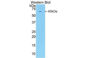 Western Blotting (WB) image for anti-Endothelial Cell-Specific Molecule 1 (ESM1) (AA 22-184) antibody (ABIN1858741)