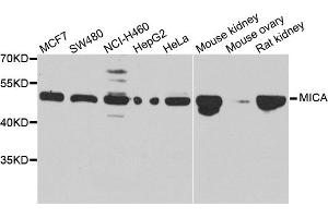 Western blot analysis of extracts of various cell lines, using MICA antibody. (MICA Antikörper)