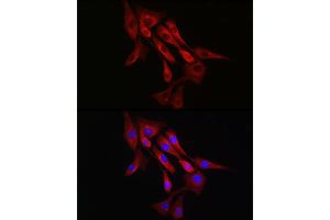 Immunofluorescence analysis of NIH/3T3 cells using α-Tubulin Rabbit mAb (ABIN7271036) at dilution of 1:100 (40x lens). (TUBA4A Antikörper)