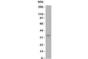 Western blot testing of Aquaporin 10 antibody and COLO320 cell lysate (Aquaporin 10 Antikörper  (C-Term))