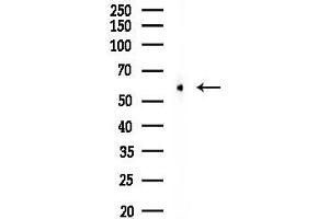 Western blot analysis of lysates from PC12 cells, using Fyn Antibody at 1/1000 dilution.