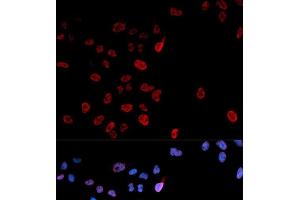 Immunofluorescence analysis of U2OS cells using Phospho-MYC(S62) Polyclonal Antibody (c-MYC Antikörper  (pSer62))