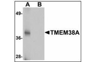 Western blot analysis of TMEM38A in rat skeletal muscle tissue lysate with TMEM38A antibody at 1 µg/ml in (A) the absence and (B) the presence of blocking peptide. (TMEM38A Antikörper  (C-Term))